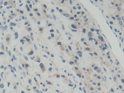 Polyclonal Antibody to ATP Binding Cassette Transporter B5 (ABCB5)