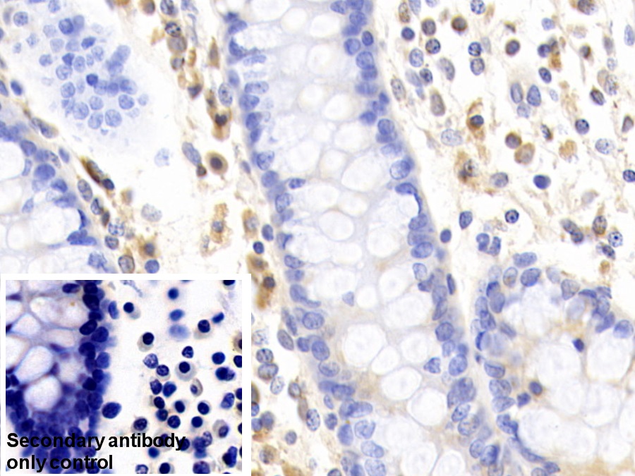 Polyclonal Antibody to Acetyl Coenzyme A Acyltransferase 1 (ACAA1)