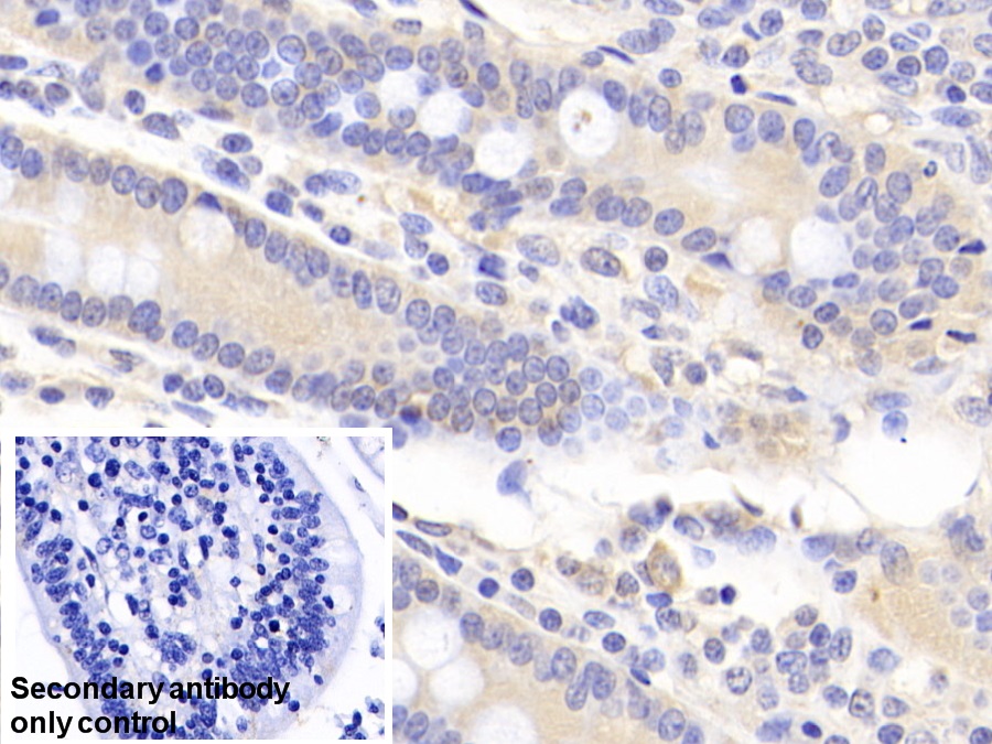 Polyclonal Antibody to Acetyl Coenzyme A Acyltransferase 2 (ACAA2)