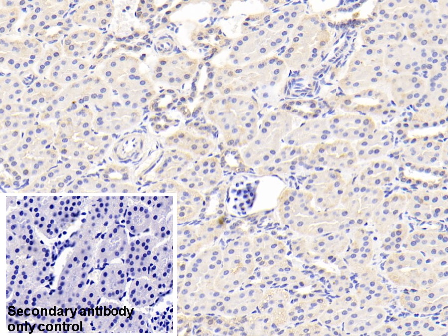 Polyclonal Antibody to Acetyl Coenzyme A Acyltransferase 2 (ACAA2)