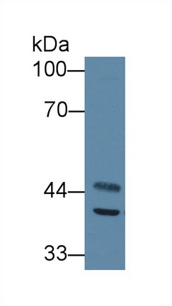 Polyclonal Antibody to Acyl Coenzyme A Dehydrogenase, C2-To-C3 Short Chain (ACADS)