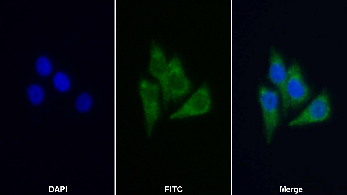 Polyclonal Antibody to Acetyl Coenzyme A Acetyltransferase 1 (ACAT1)