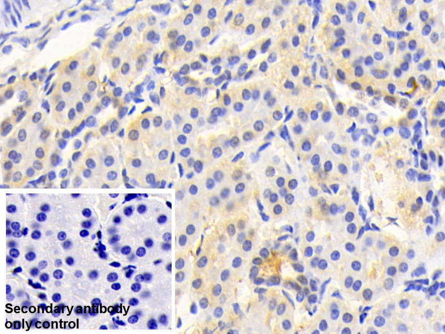 Polyclonal Antibody to Acetyl Coenzyme A Acetyltransferase 1 (ACAT1)