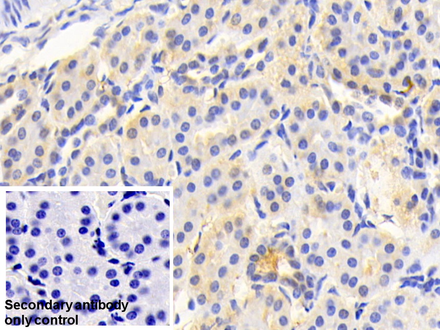 Polyclonal Antibody to Acetyl Coenzyme A Acetyltransferase 1 (ACAT1)