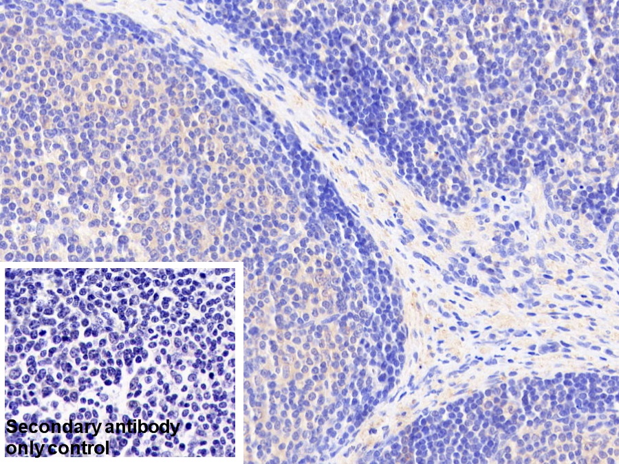 Polyclonal Antibody to Acetyl Coenzyme A Acetyltransferase 1 (ACAT1)