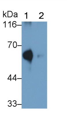 Polyclonal Antibody to Acyl Coenzyme A Synthetase Medium Chain Family, Member 1 (ACSM1)