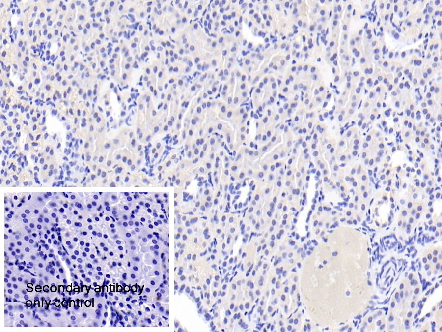 Polyclonal Antibody to Acyl Coenzyme A Synthetase Medium Chain Family, Member 1 (ACSM1)