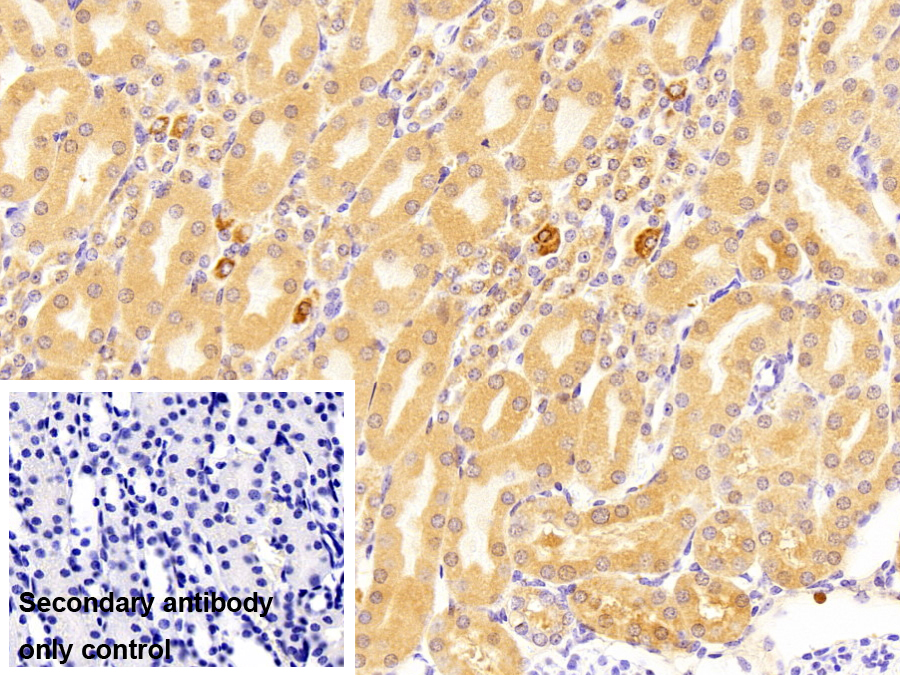 Polyclonal Antibody to Acyl Coenzyme A Synthetase Long Chain Family, Member 1 (ACSL1)