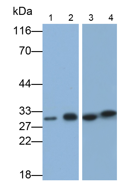 Polyclonal Antibody to Dodecenoyl Coenzyme A Delta Isomerase (DCI)