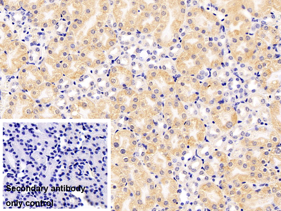 Polyclonal Antibody to Dodecenoyl Coenzyme A Delta Isomerase (DCI)