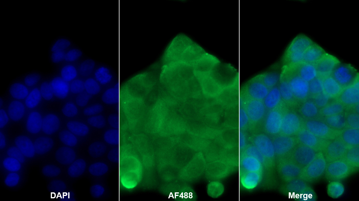 Polyclonal Antibody to Diazepam Binding Inhibitor (DBI)