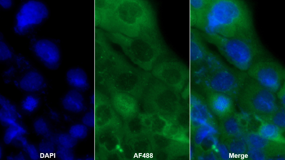 Polyclonal Antibody to Apolipoprotein L (APOL1)