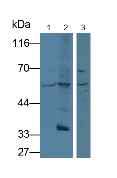 Polyclonal Antibody to Lipolysis Stimulated Lipoprotein Receptor (LSR)