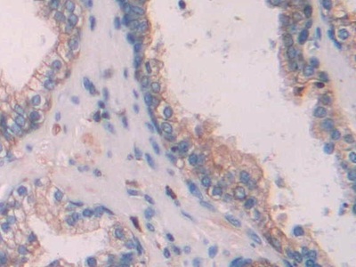 Polyclonal Antibody to Keratin 6C (KRT6C)