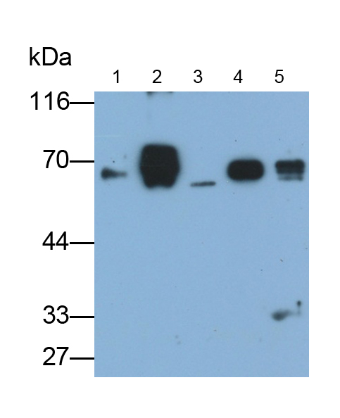 Polyclonal Antibody to Keratin 6C (KRT6C)