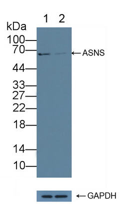 Polyclonal Antibody to Asparagine Synthetase (ASNS)