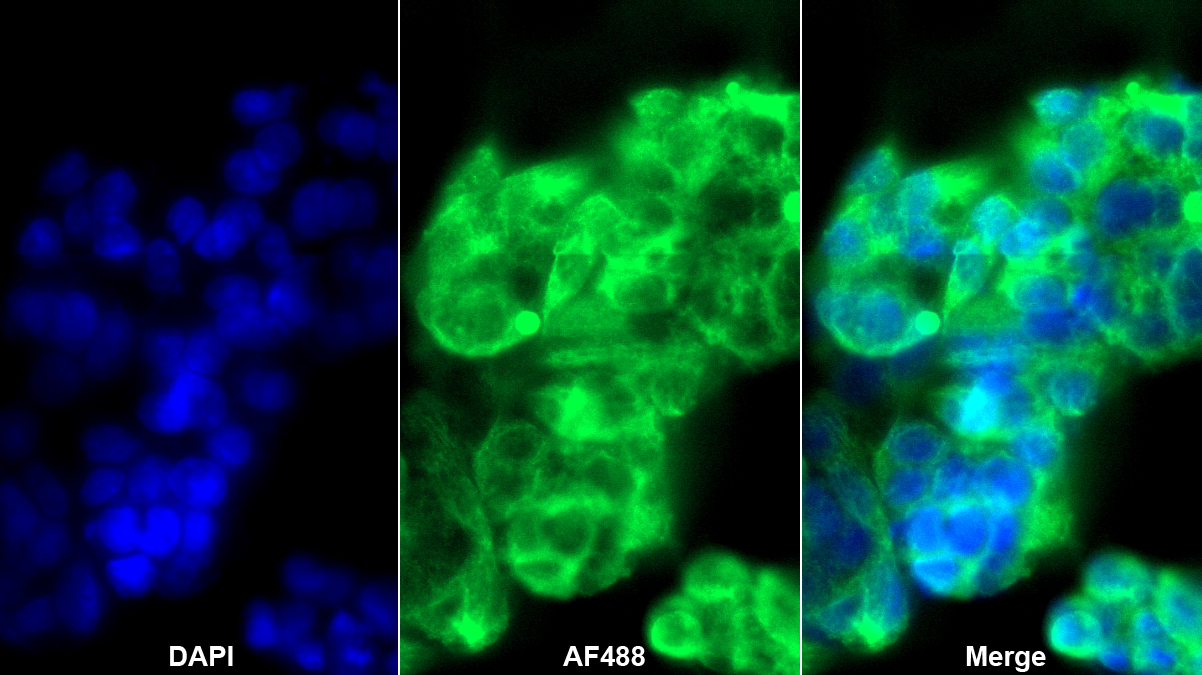 Polyclonal Antibody to Glutamine synthetase (GS)