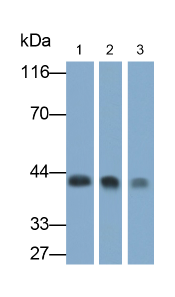 Polyclonal Antibody to Glutamine synthetase (GS)