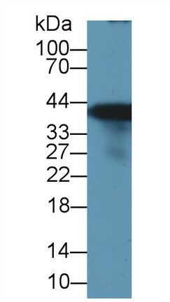 Polyclonal Antibody to Glutamine synthetase (GS)