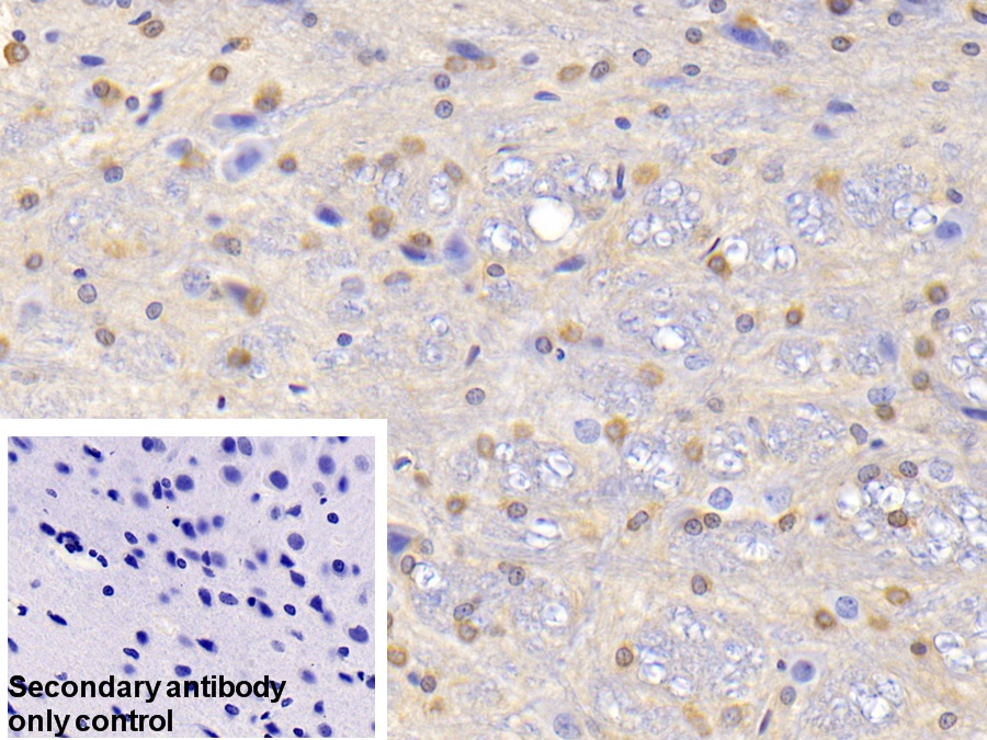 Polyclonal Antibody to Glutamine synthetase (GS)