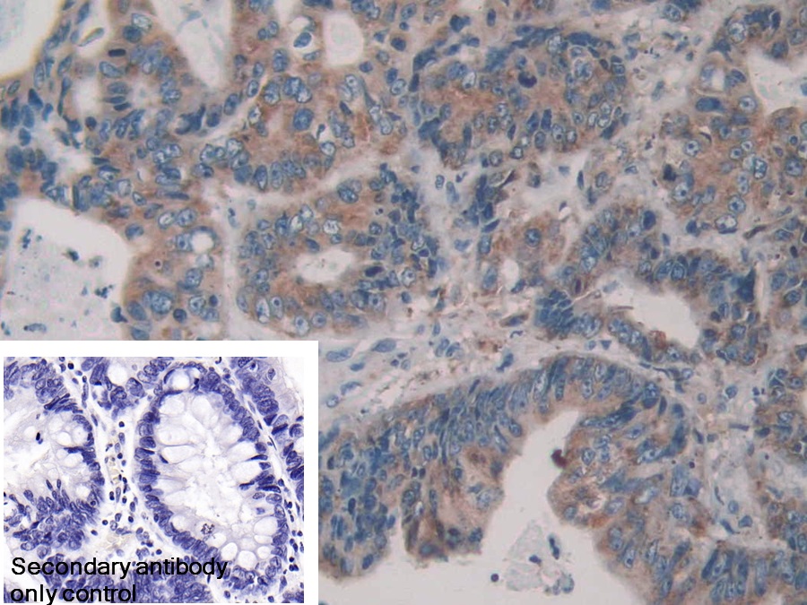 Polyclonal Antibody to Protein Disulfide Isomerase A4 (PDIA4)