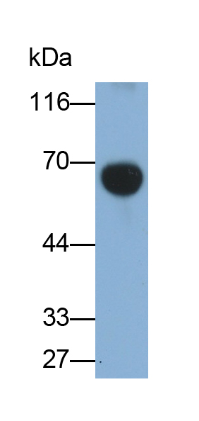 Polyclonal Antibody to Complement Component 8a (C8a)