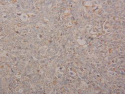 Polyclonal Antibody to Arginase II (Arg2)