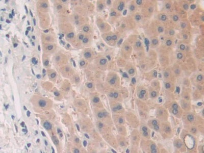Polyclonal Antibody to Phospholipase A2, Group X (PLA2G10)