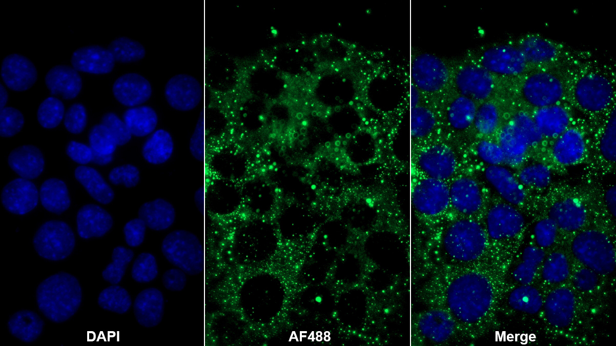 Polyclonal Antibody to Phospholipase C Delta 1 (PLCd1)