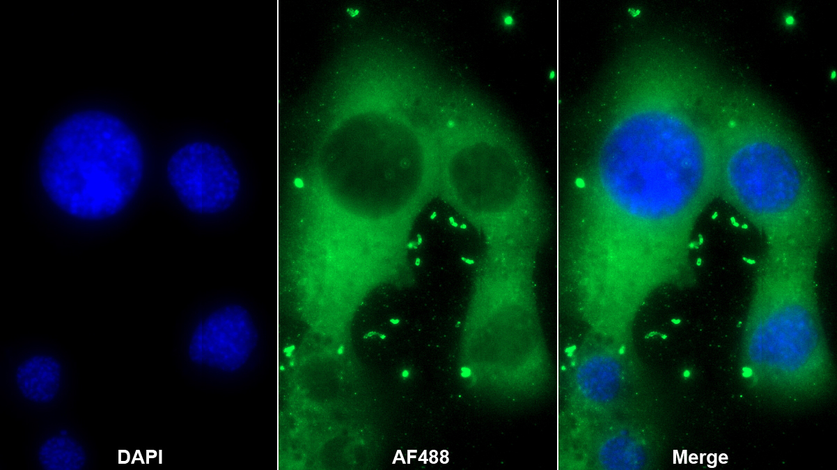 Polyclonal Antibody to Phospholipase C Zeta 1 (PLCz1)
