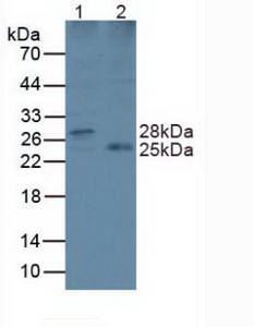 Polyclonal Antibody to Lysophospholipase II (LYPLA2)