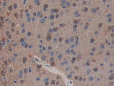 Polyclonal Antibody to Phospholipase A2 Receptor 1 (PLA2R1)