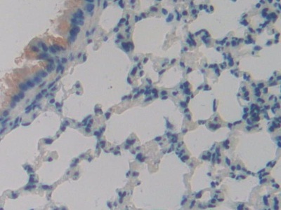 Polyclonal Antibody to Phospholipase A2 Receptor 1 (PLA2R1)