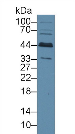 Polyclonal Antibody to Branched Chain Aminotransferase 1, Cytosolic (BCAT1)