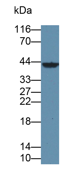 Polyclonal Antibody to Branched Chain Aminotransferase 1, Cytosolic (BCAT1)