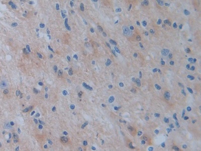 Polyclonal Antibody to Phosphoserine Aminotransferase 1 (PSAT1)