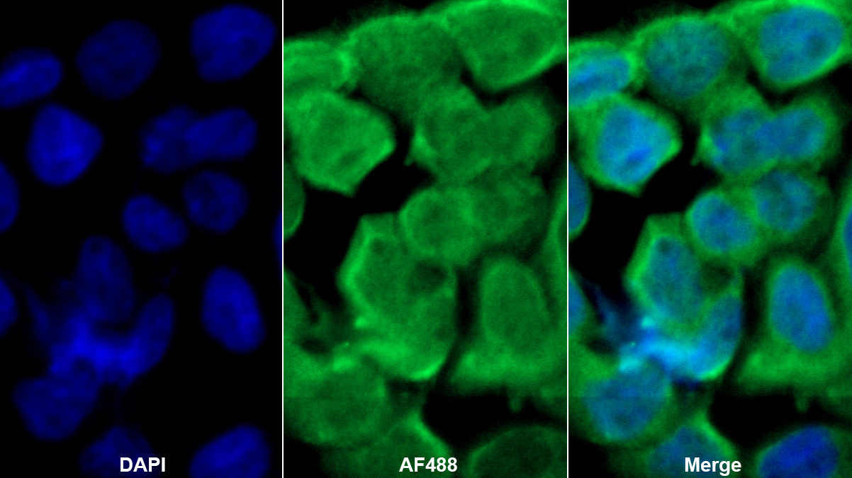 Polyclonal Antibody to Phosphoserine Aminotransferase 1 (PSAT1)