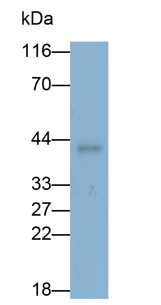 Polyclonal Antibody to Phosphoserine Aminotransferase 1 (PSAT1)