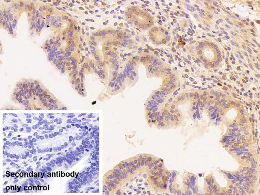 Polyclonal Antibody to Small Nuclear Ribonucleoprotein Polypeptide D3 (SNRPD3)