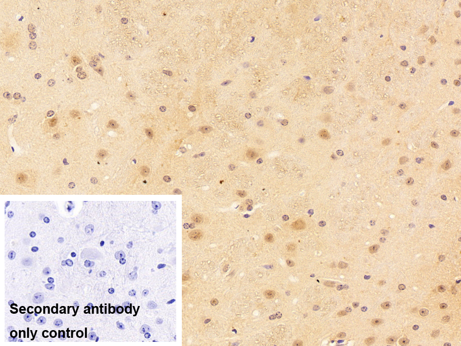 Polyclonal Antibody to Small Nuclear Ribonucleoprotein Polypeptide D3 (SNRPD3)