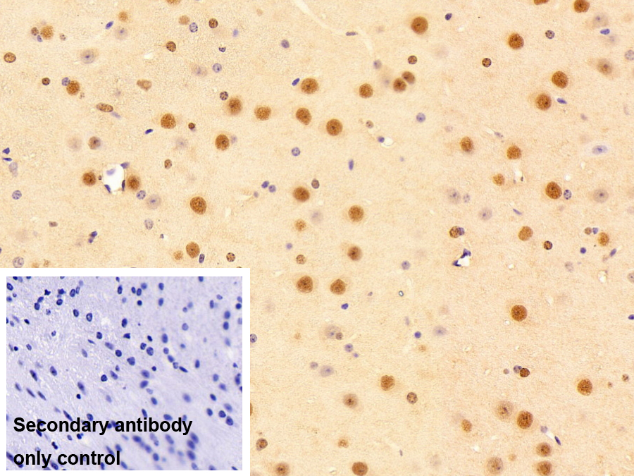Polyclonal Antibody to Small Nuclear Ribonucleoprotein Polypeptide A (SNRPA)