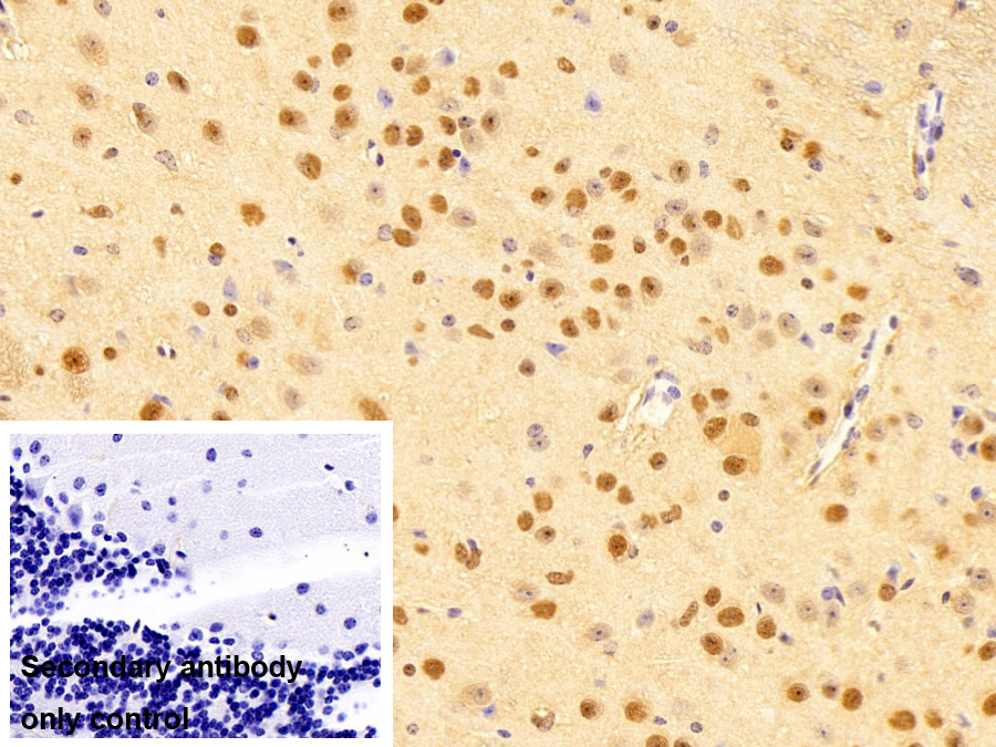 Polyclonal Antibody to Small Nuclear Ribonucleoprotein Polypeptide A (SNRPA)
