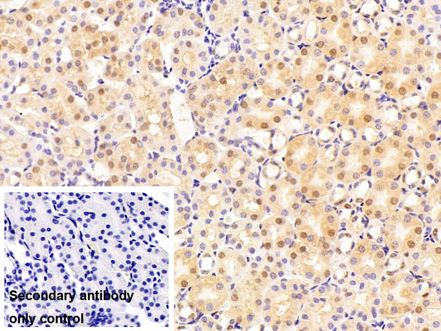 Polyclonal Antibody to Small Nuclear Ribonucleoprotein Polypeptide A (SNRPA)