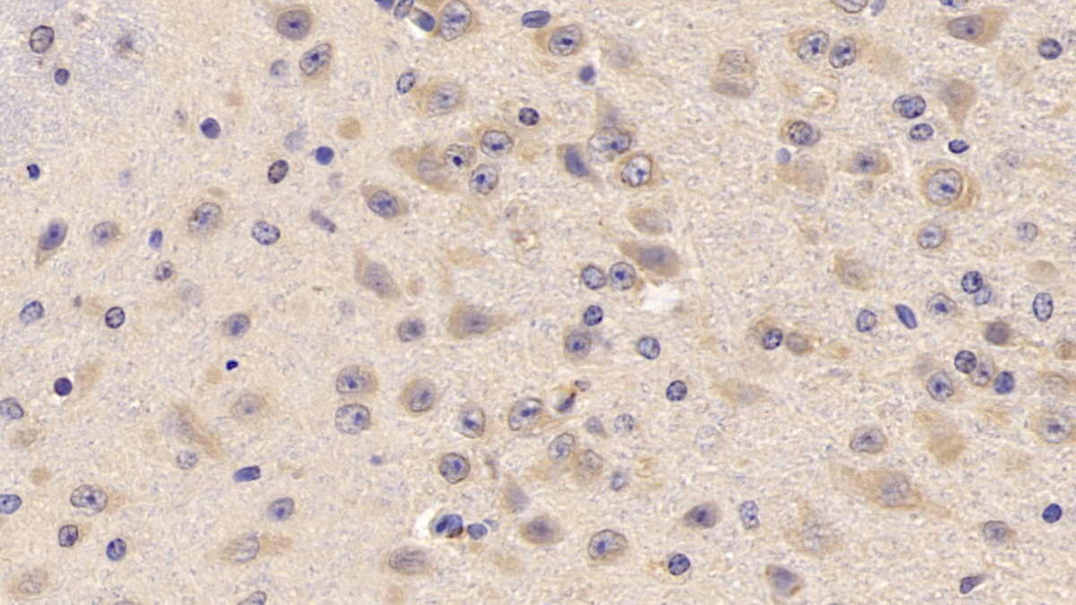 Polyclonal Antibody to Tumor Necrosis Factor Receptor Superfamily, Member 14 (TNFRSF14)