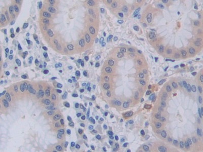 Polyclonal Antibody to Tumor Necrosis Factor Ligand Superfamily, Member 9 (TNFSF9)
