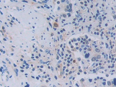 Polyclonal Antibody to Tumor Necrosis Factor Ligand Superfamily, Member 9 (TNFSF9)