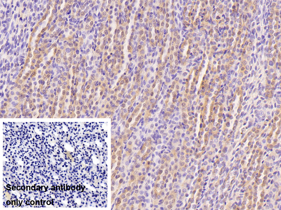 Polyclonal Antibody to Pregnane X Receptor (PXR)