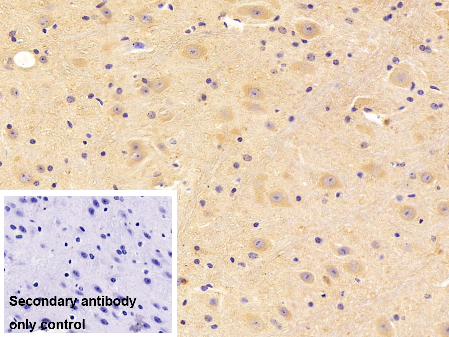 Polyclonal Antibody to Protein Phosphatase 3, Catalytic Subunit Beta Isoform (PPP3Cb)