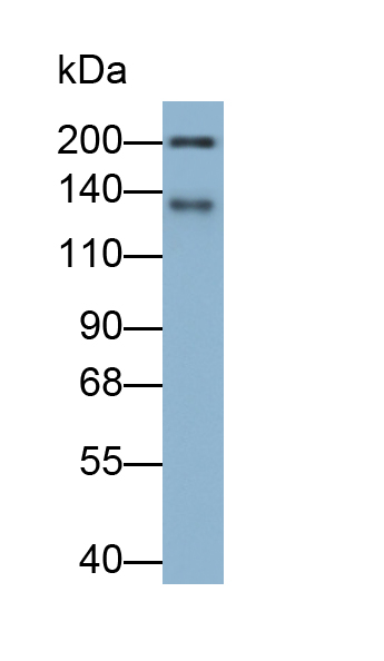 Polyclonal Antibody to Neurofilament, Heavy Polypeptide (NEFH)