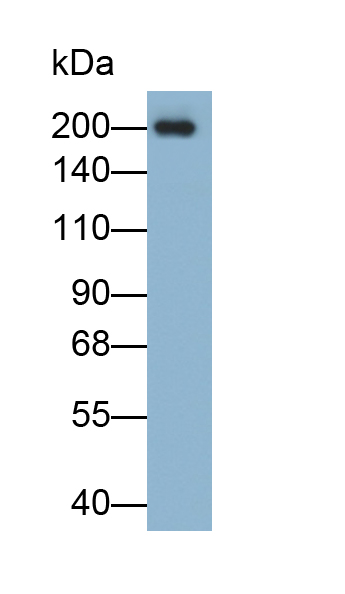 Polyclonal Antibody to Neurofilament, Heavy Polypeptide (NEFH)